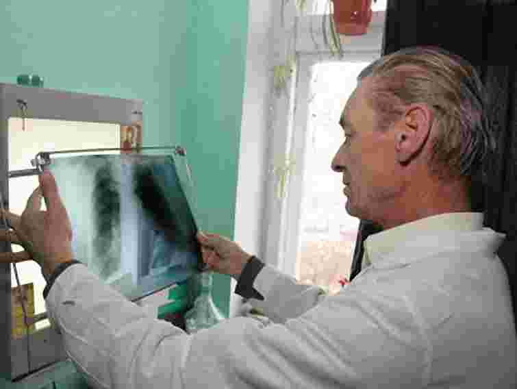 Понад 100 осіб на Львівщині після кору захворіли на пневмонію