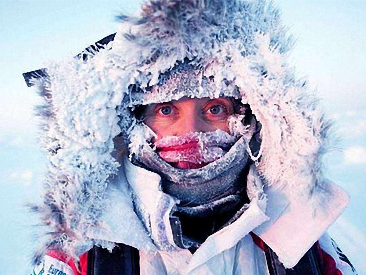 24 жителів Львівщини госпіталізовано з обмороженням