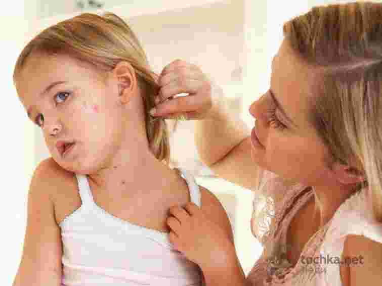 З початку року на кір захворіло вдвічі більше українців, ніж торік