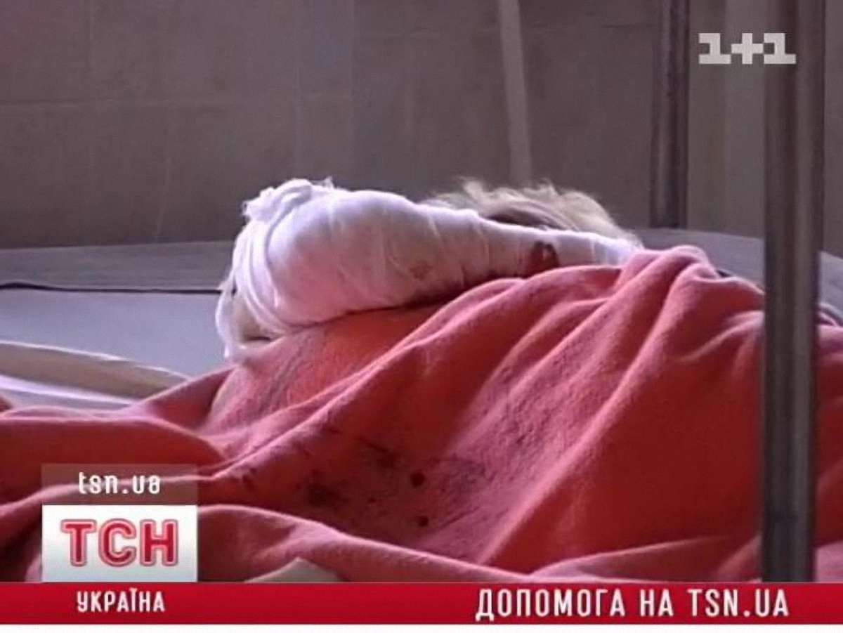 У Львові пройде акція на підтримку понівеченої ґвалтівниками дівчини
