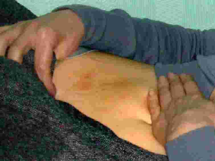 Судмедекспертиза виявила два синці на тілі Тимошенко