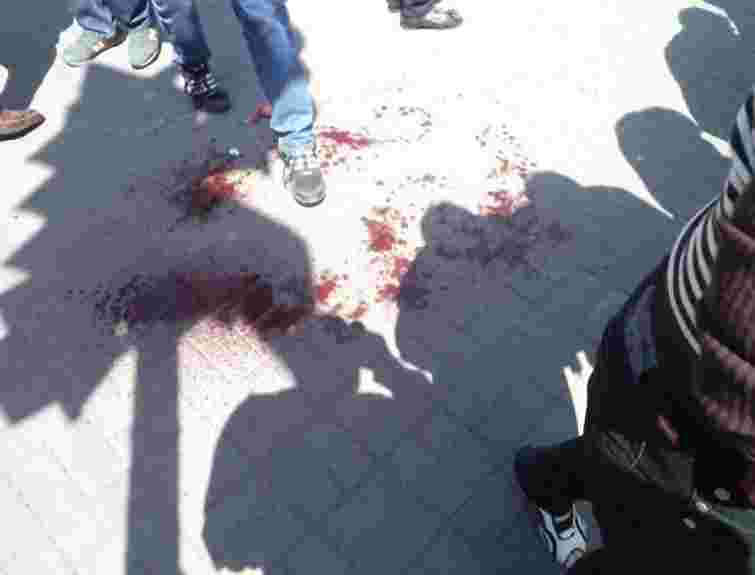 У Запоріжжі вибухнула урна – постраждала дівчина