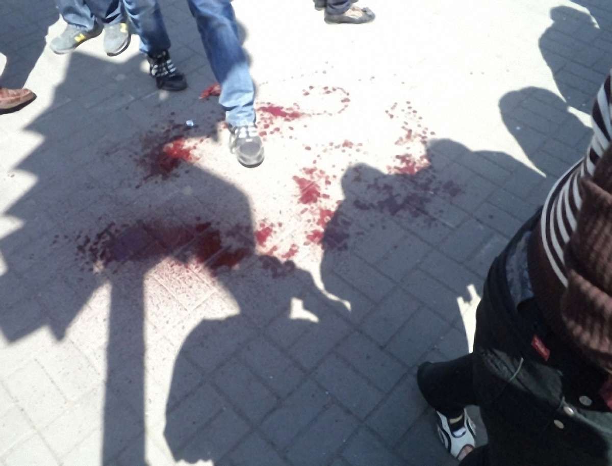У Запоріжжі вибухнула урна – постраждала дівчина