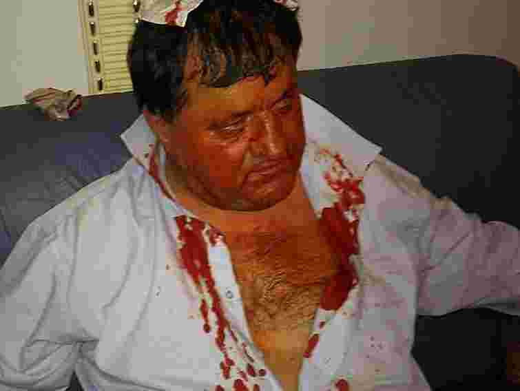 Закривавленого БЮТівця з Верховної Ради вивезли на швидкій