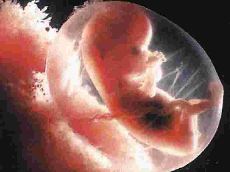 Понад 800 тисяч пар в Україні не може мати дітей