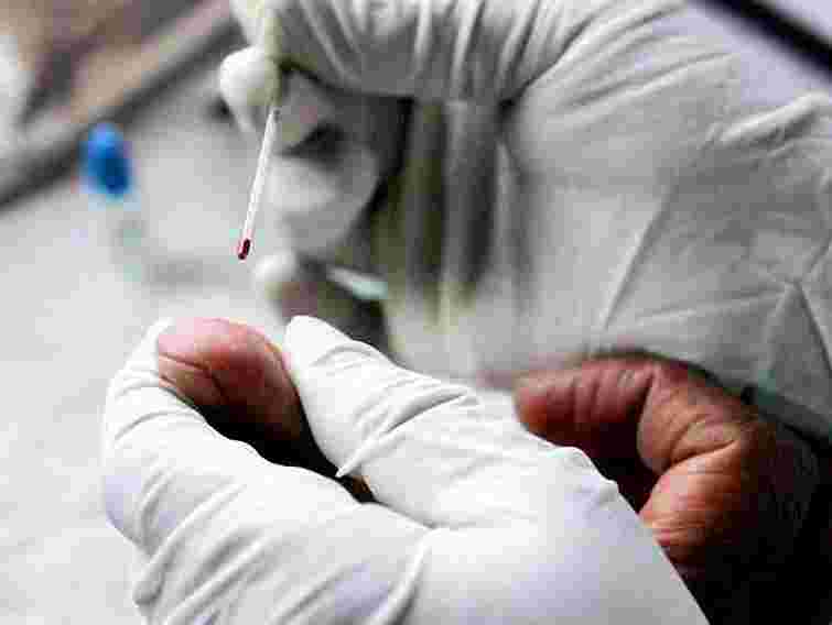 У Львові безкоштовно перевірятимуть на гепатит