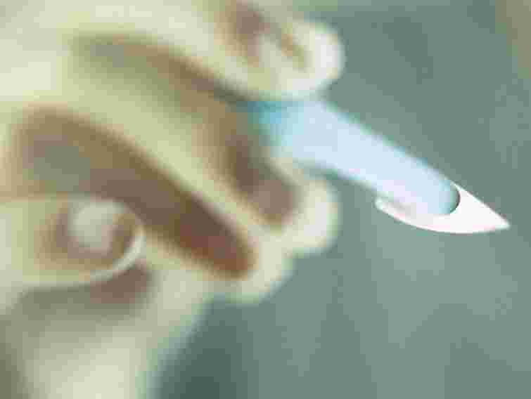 На Прикарпатті порушили справу за фактом смерті прооперованої жінки