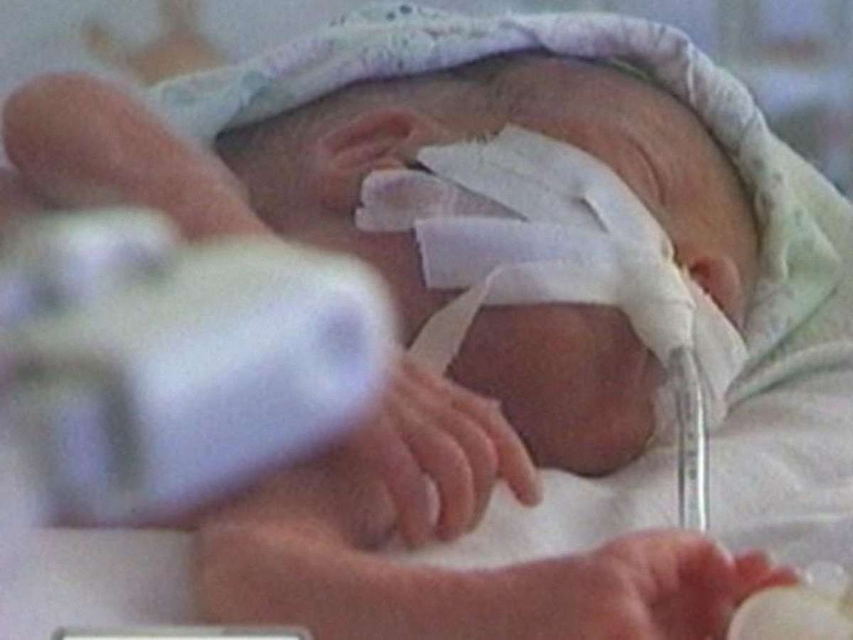 7 тисяч українських немовлят потребують операцій на серці