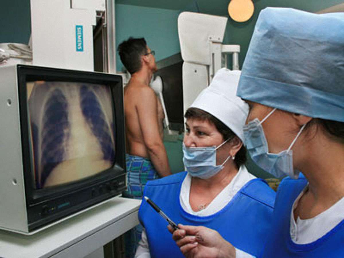 Минулого року у Львові від туберкульозу померли 60 осіб