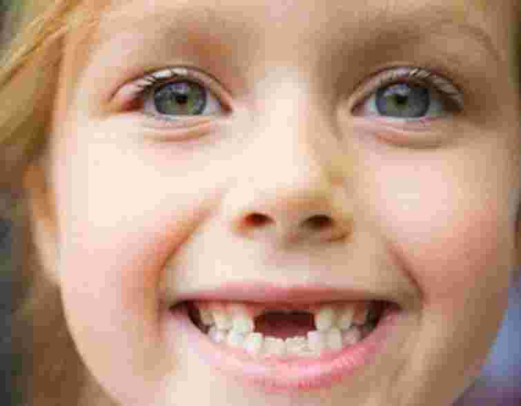 Львів’ян навчатимуть, як не допустити карієсу в дітей