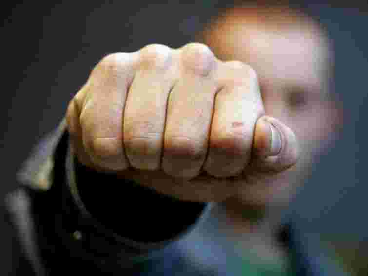 На Закарпатті невідомий побив заступника мера Чопа