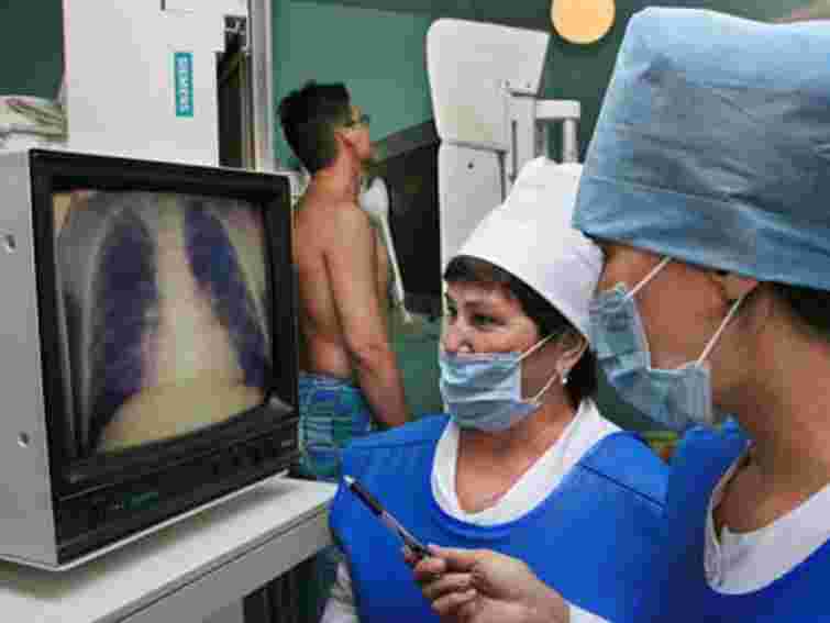 Торік у Львові від туберкульозу померло 60 осіб