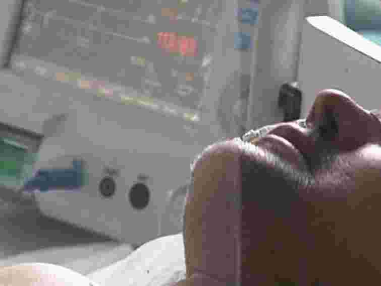 Уряд затвердив державну програму лікування гепатитів