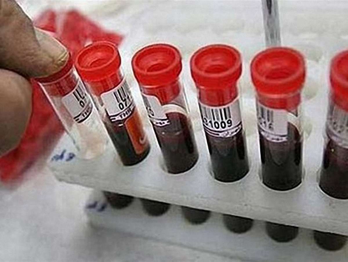 На Львівщині в лікарні – 15 хворих на менінгіт, з них 5 – діти