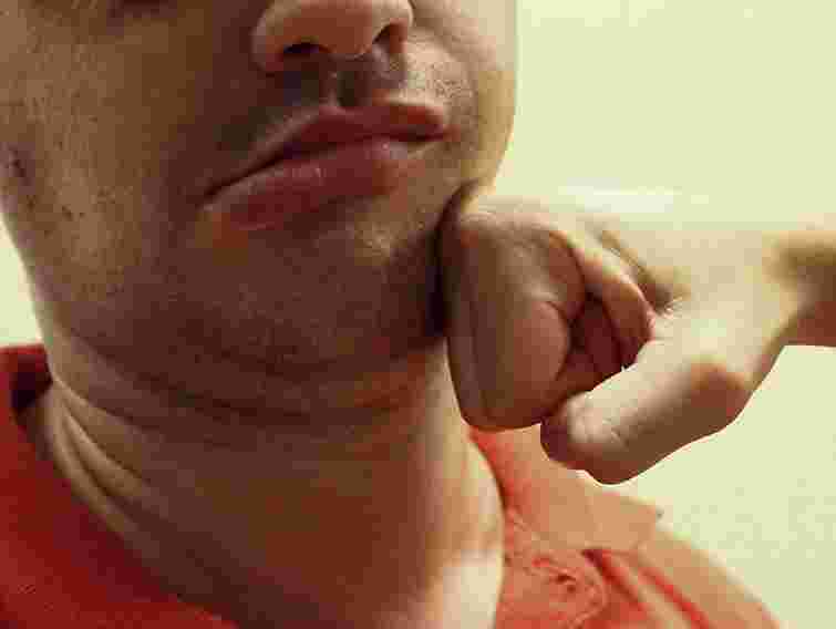 Регіонала підозрюють у побитті чоловіка на Закарпатті