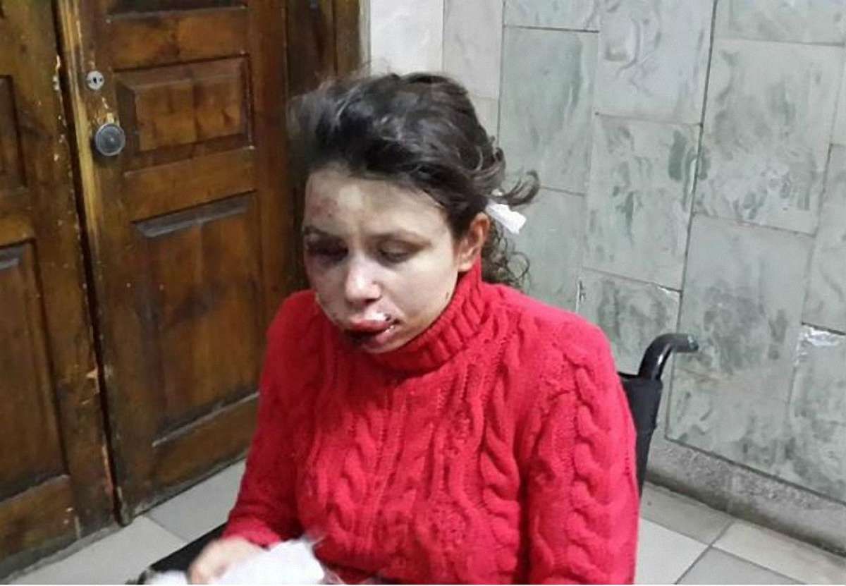 Чорновол розповіла про свій стан і замовників побиття