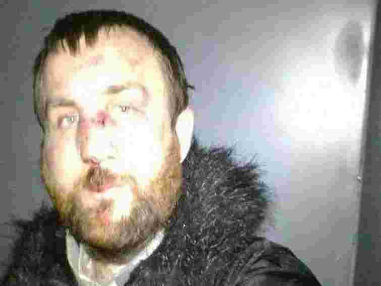 Зниклого львівського фотографа знайшли в Києві побитим