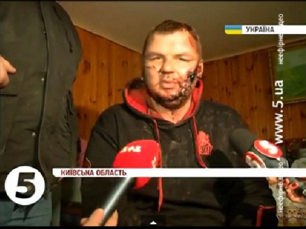 У лікарні з Булатовим проводяться слідчі дії, – заява МВС