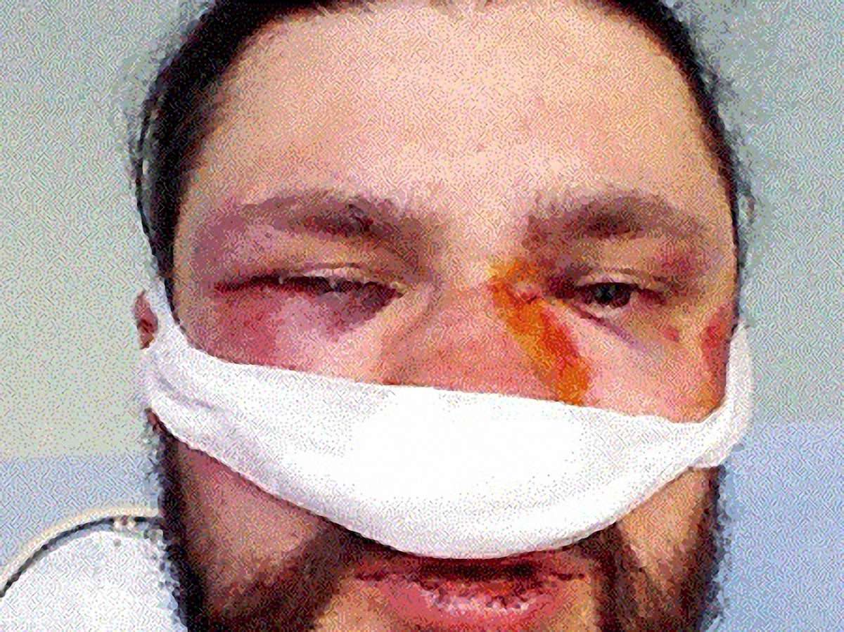 У сутичках в Києві вже постраждало більше 20 журналістів, – ІМІ