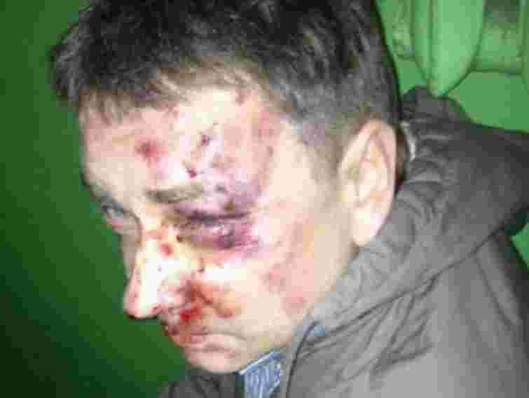 У Сумах побили відомого журналіста і письменника