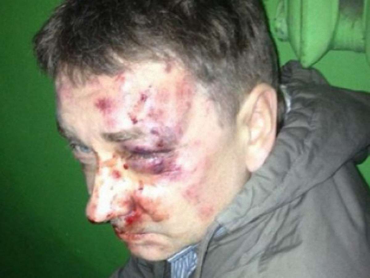 У Сумах побили відомого журналіста і письменника