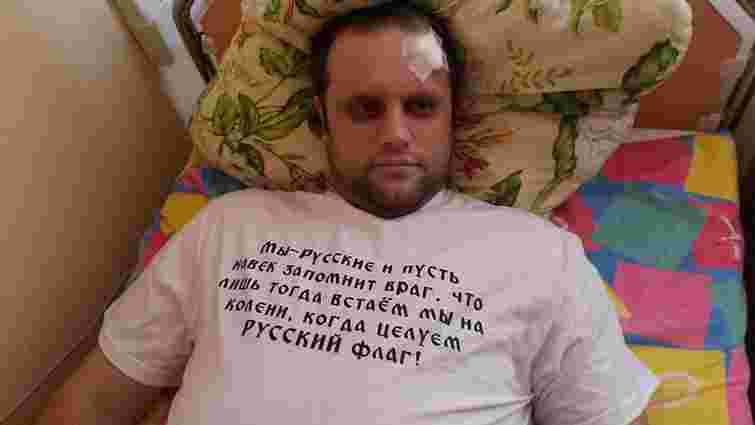 В мережі з'явилися перші фото Губарєва після замаху