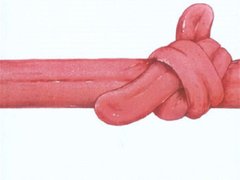 Розрубати мовний вузол