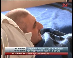 Пластичні хірурги США та Канади прооперували поранених українських бійців
