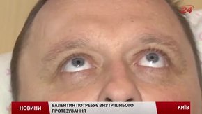 Доброволець Валентин Бородін потребує протезування