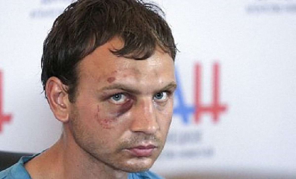 Бойовики катували полоненого військового ЗСУ, аби той дав неправдиві свідчення