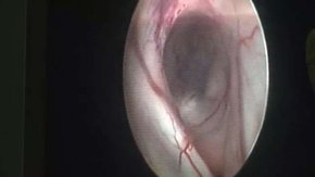 У львівській дитячій лікарні сьогодні оперував професор з Канади