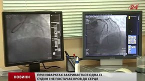 Інфаркти та інсульти молодшають, — лікарі