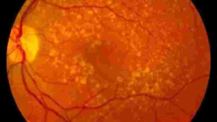 Вчені виростили колбочки людського ока зі стовбурових клітин