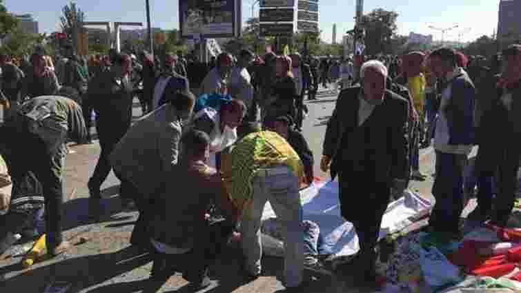 Теракт у столиці Туреччини забрав життя 86 людей