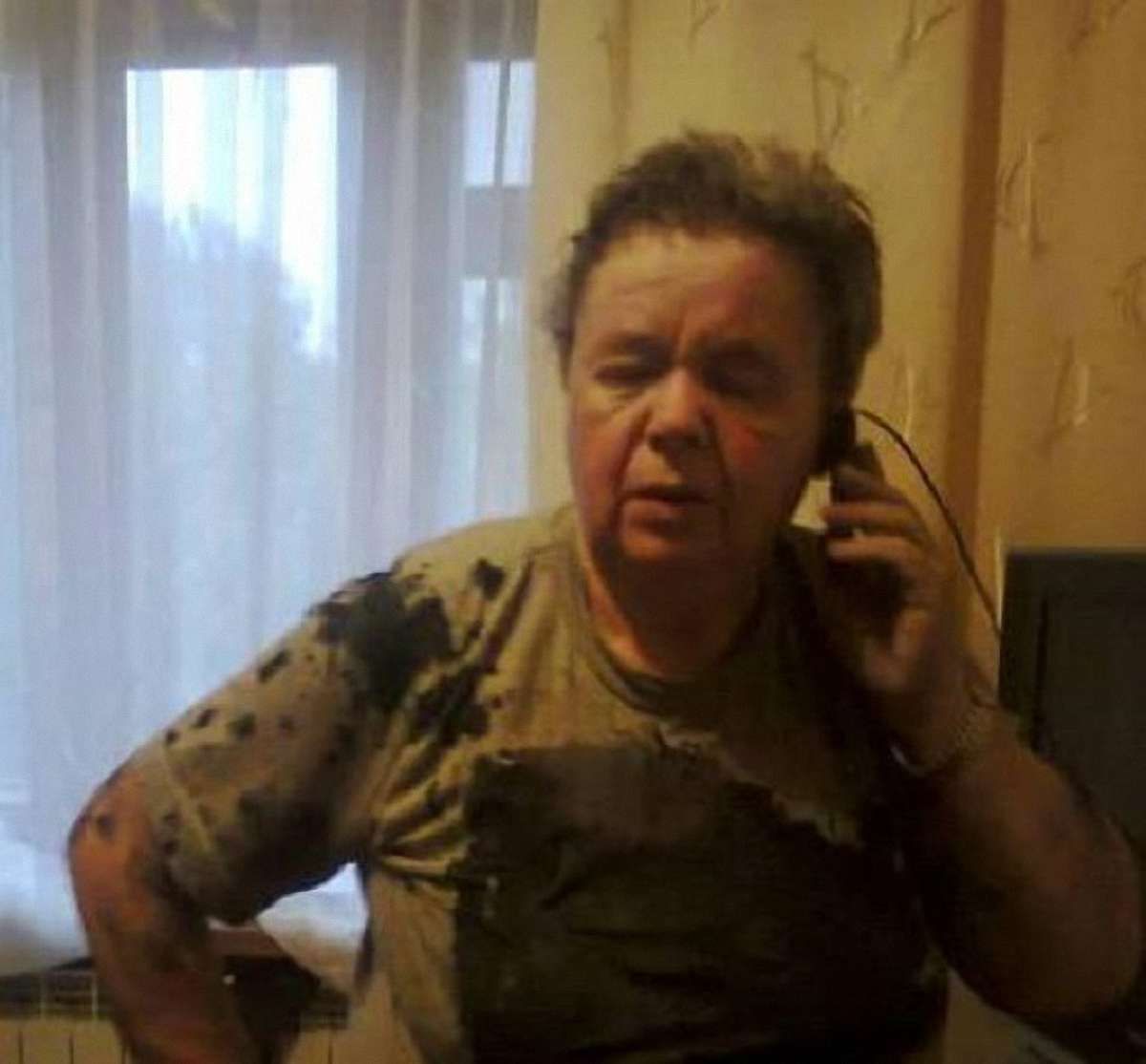 У Рівному кандидата в депутати облили хімічною речовиною