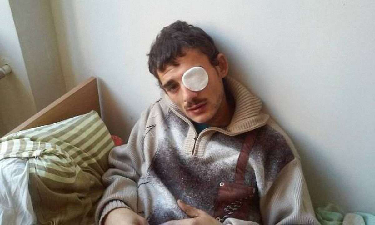 Ужгородець для розваги вистрелив в око ромові