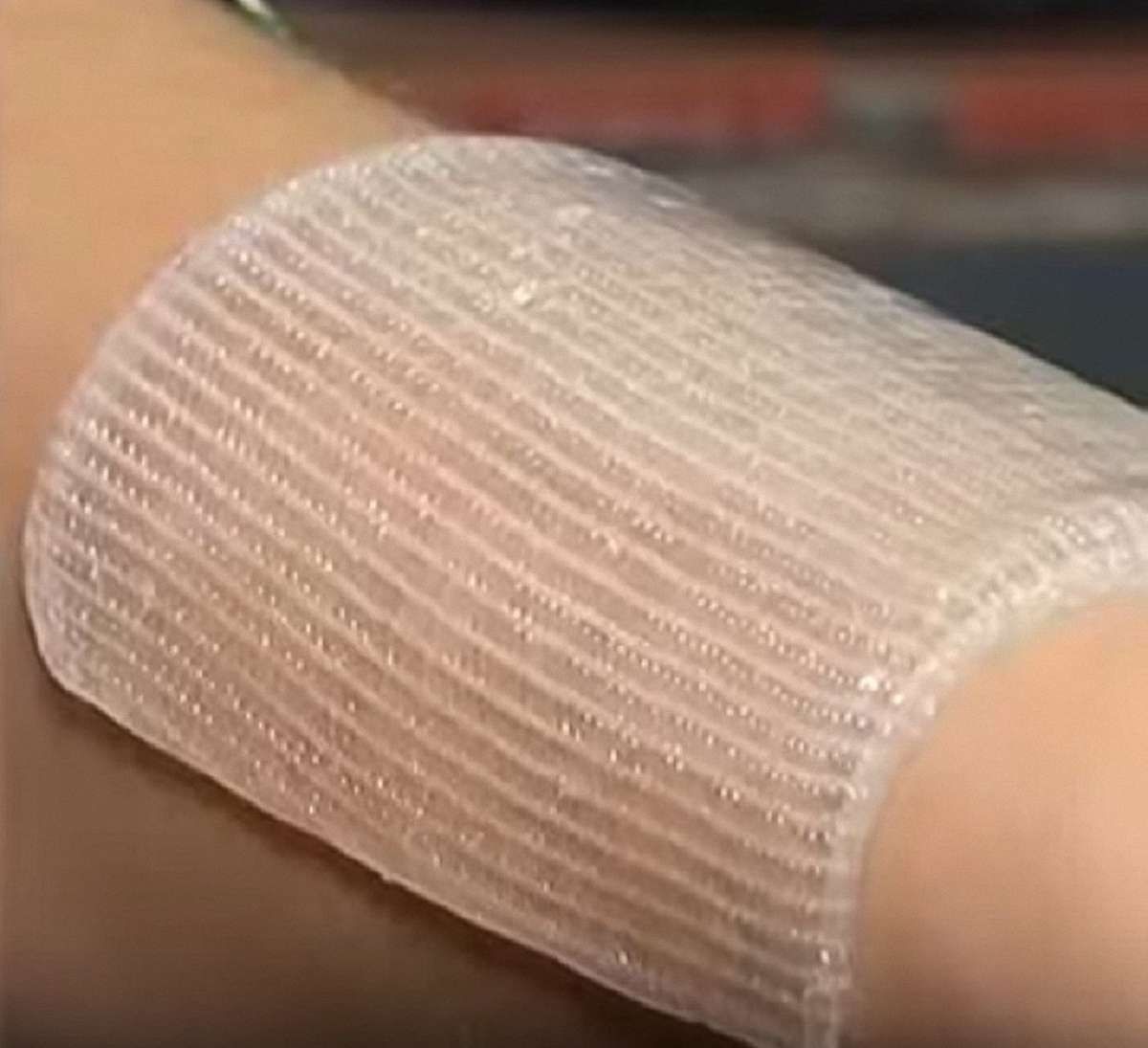 Львівські науковці розробили гідрогелеві медичні пов’язки для воїнів АТО