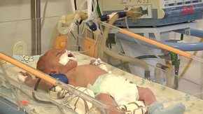 Львівська дитяча клінічна лікарня отримала кардіологічне обладнання