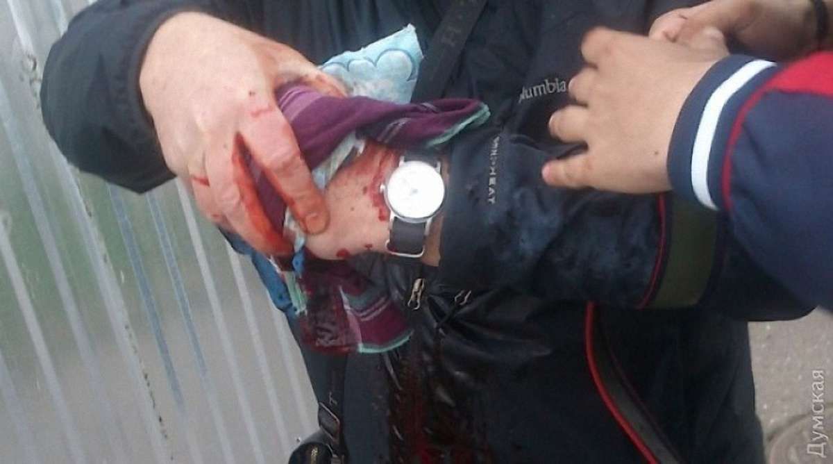 В Одесі на жалобному мітингу стався вибух, є поранений