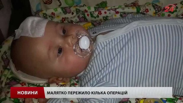 У Львові на виставці «Весна текстури» збирають кошти для чотиримісячного малюка