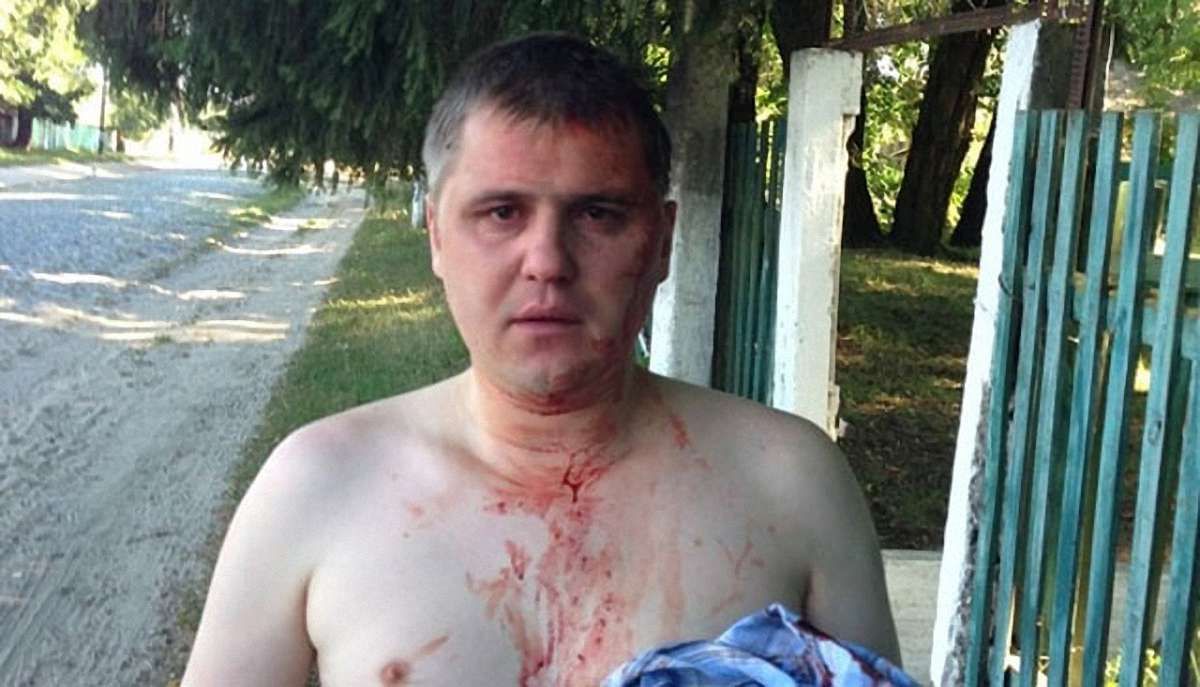 На Чернігівщині під час агітації побили кандидата в депутати від забороненої КПУ