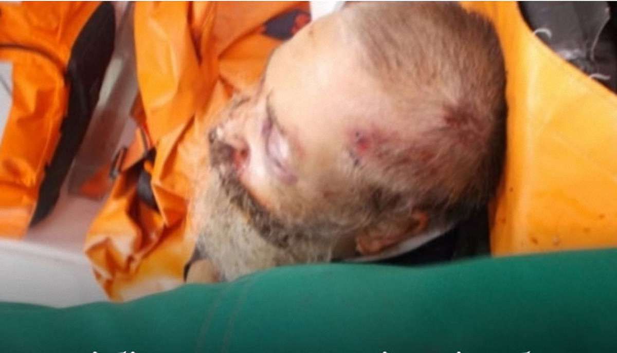У Житомирі поліція затримала зловмисників, які жорстоко побили рабина