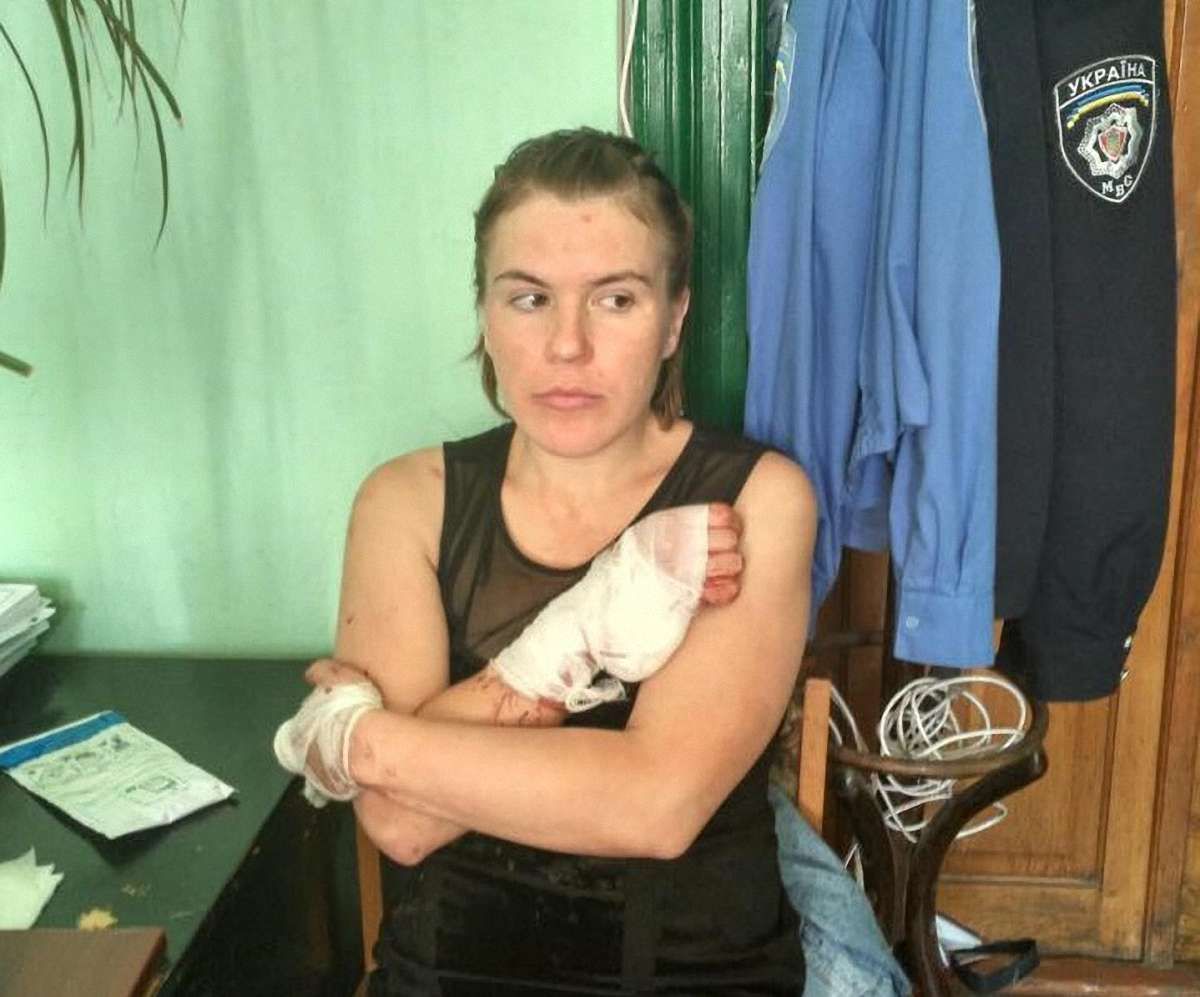Із львівської психлікарні втекла росіянка, яка облила кислотою працівницю РАЦСу