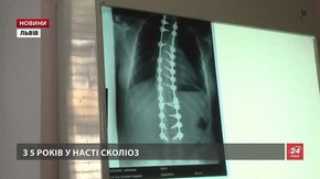 12-річна Настя зі Львова не зможе рости без дорогої пластини для хребта
