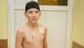 12-річному хлопчику у Львові вперше поставили протез «на виріст»