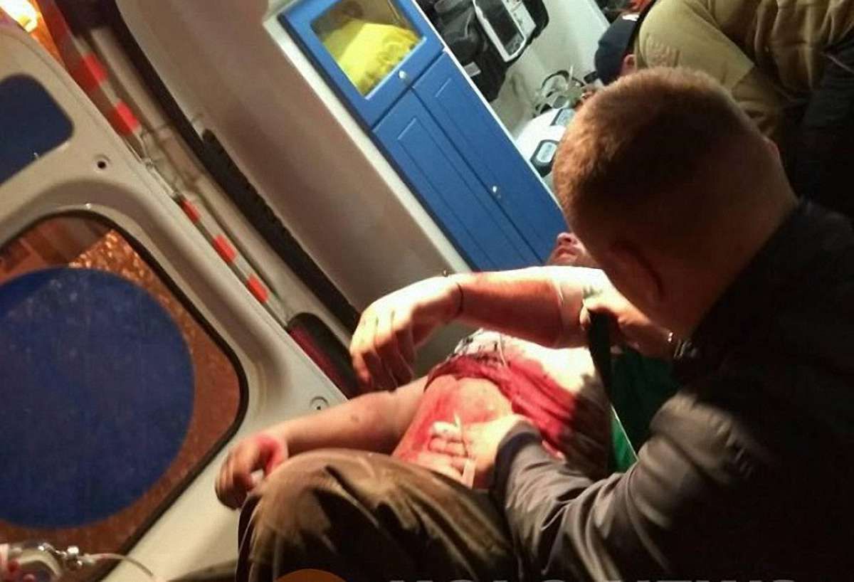 У Полтаві сталися сутички між активістами та представниками забудовника, є поранений