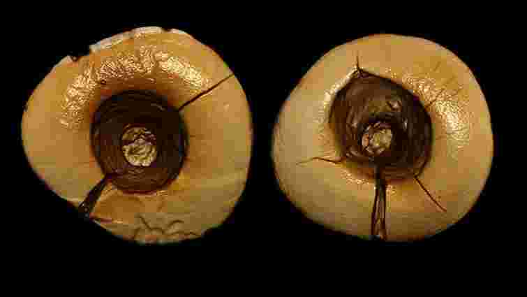 Археологи виявили зубні пломби, яким 13 тисяч років