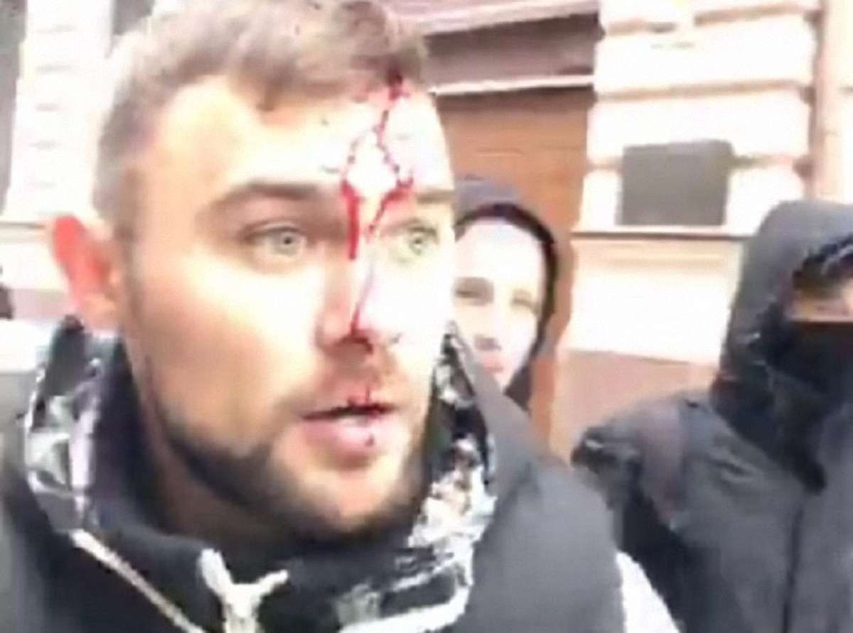 У Харкові блокувальнику «Сбербанку» розбили голову