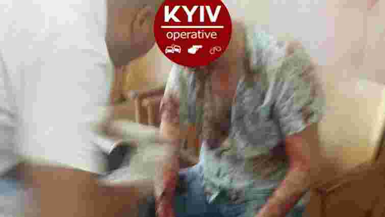 У київському ЖЕКу на Подолі розстріляли чоловіка і викрали в нього ₴200 тис.
