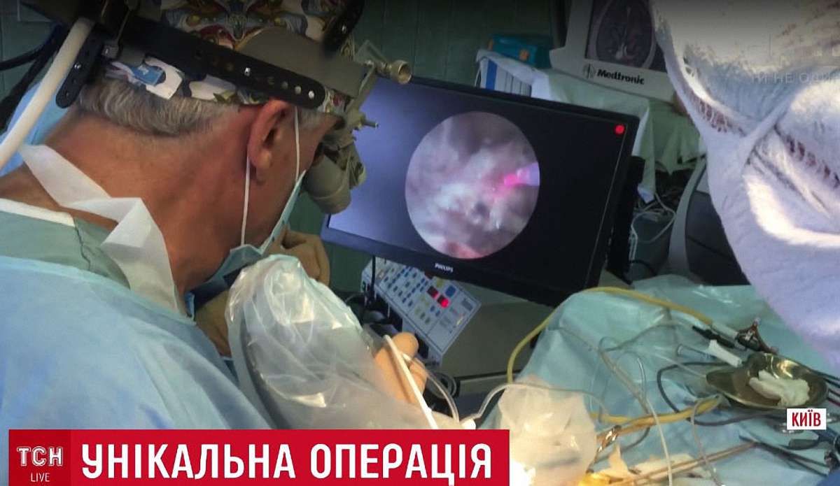 Українські хірурги провели унікальну операцію з видалення пухлини мозку